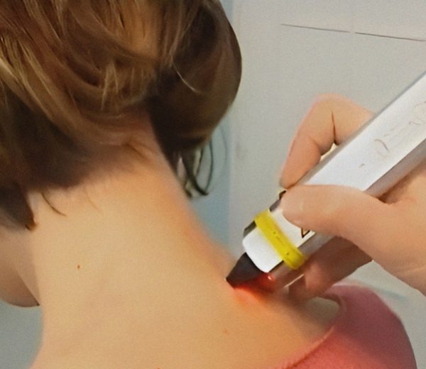 kezeles-lagylezer-terapia Lágylézer terápiával a beteg gyorsabban gyógyul.